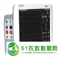廣州供應心電監(jiān)護儀全國銷售